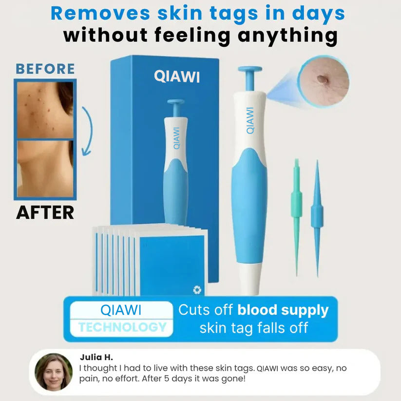 QIAWI Skin Tag Remover Kit — Gentle, Fast & Pain-Free