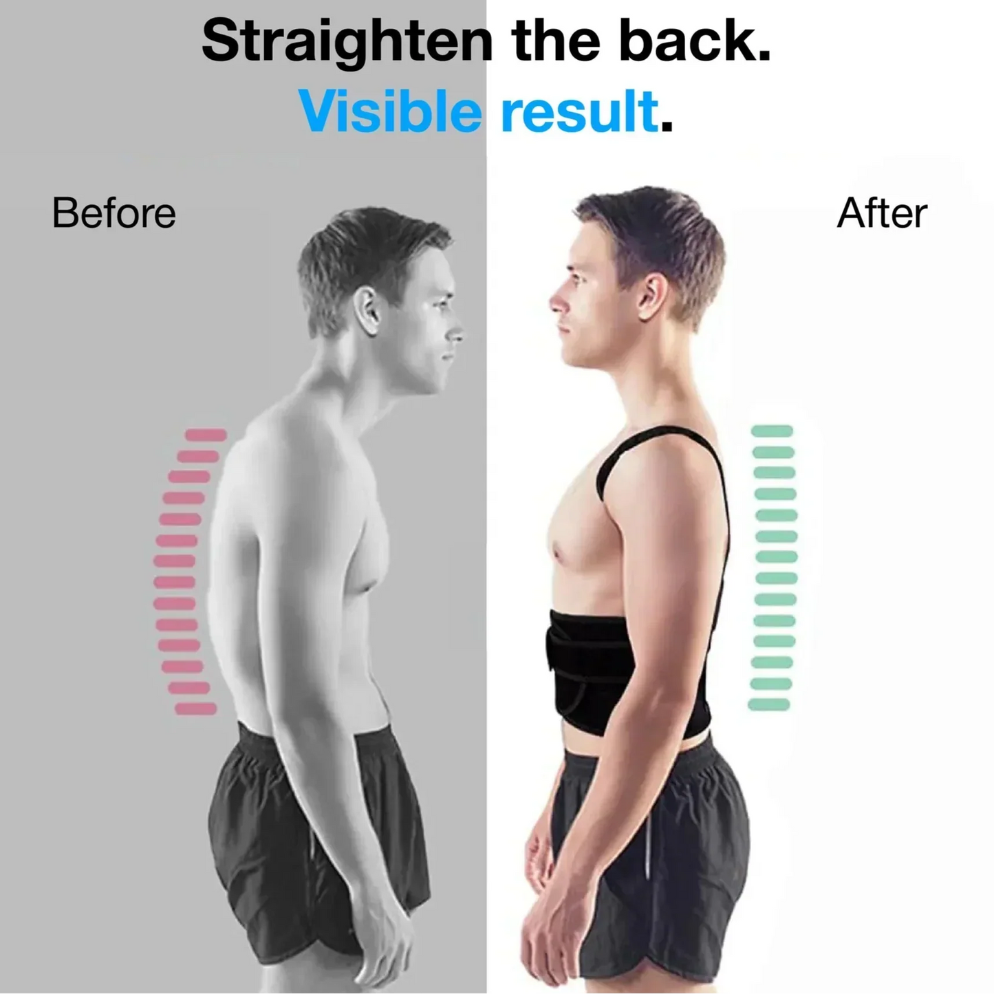(🔥Limited Time Half Price Sale🔥)👦HZA™ Posture Corrector👧