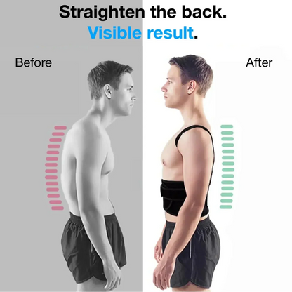 (🔥Limited Time Half Price Sale🔥)👦HZA™ Posture Corrector👧